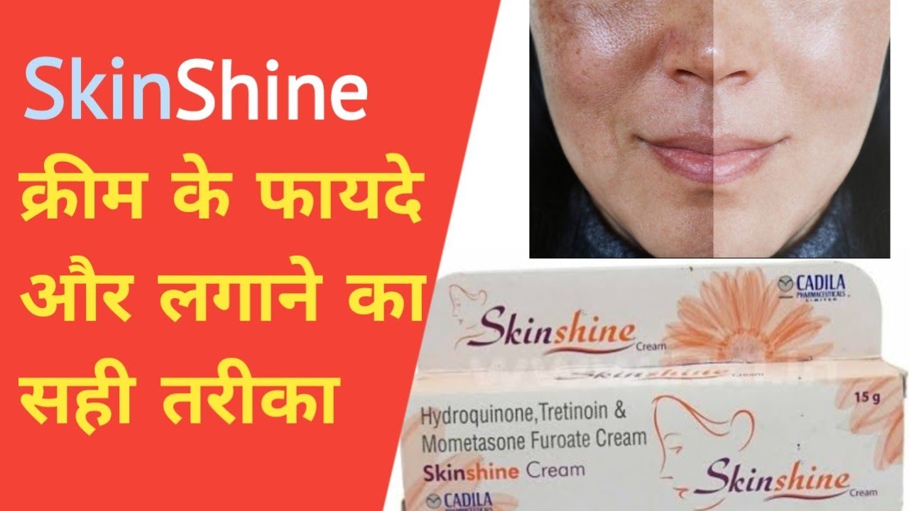 Skinshine Cream Uses In Hindi L Hydroquinone Tretinoin Mometasone Skinshine Cream Uses In Hindi L Hydroquinone Tretinoin Mometasone