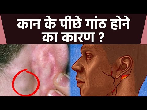 वीडियो: कान के पीछे कौन सी ग्रंथि होती है?