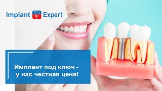 Имплант под ключ, у нас честная цена!