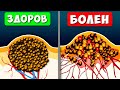 Что Будет, если Сорвал РОДИНКУ, и Что Делать... Приведёт ли это к Раку кожи? (Меланома)