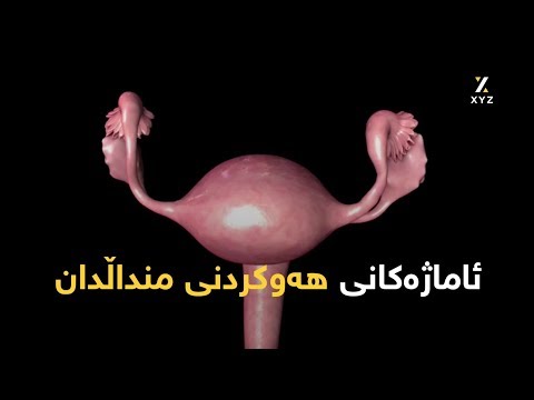ئاماژەکانی هەوکردنی منداڵدان