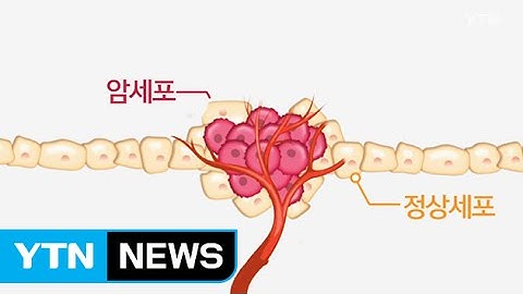 표적 항암제 걸림돌 