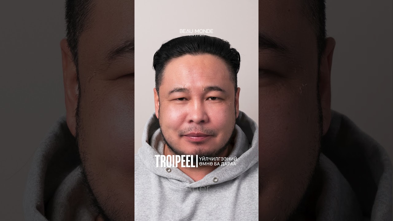 Beaumonde — Troipeel 01