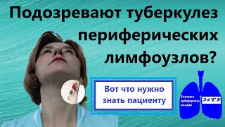 Туберкулез периферических лимфатических узлов