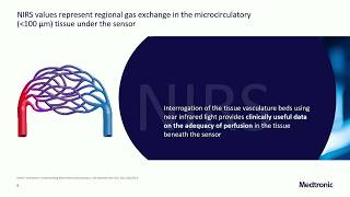 NIRS Monitoring in Critically Ill Children