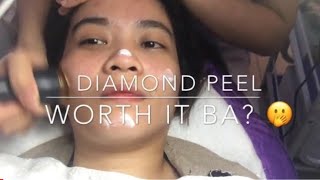 FIRST TIME DIAMOND PEEL screenshot 3