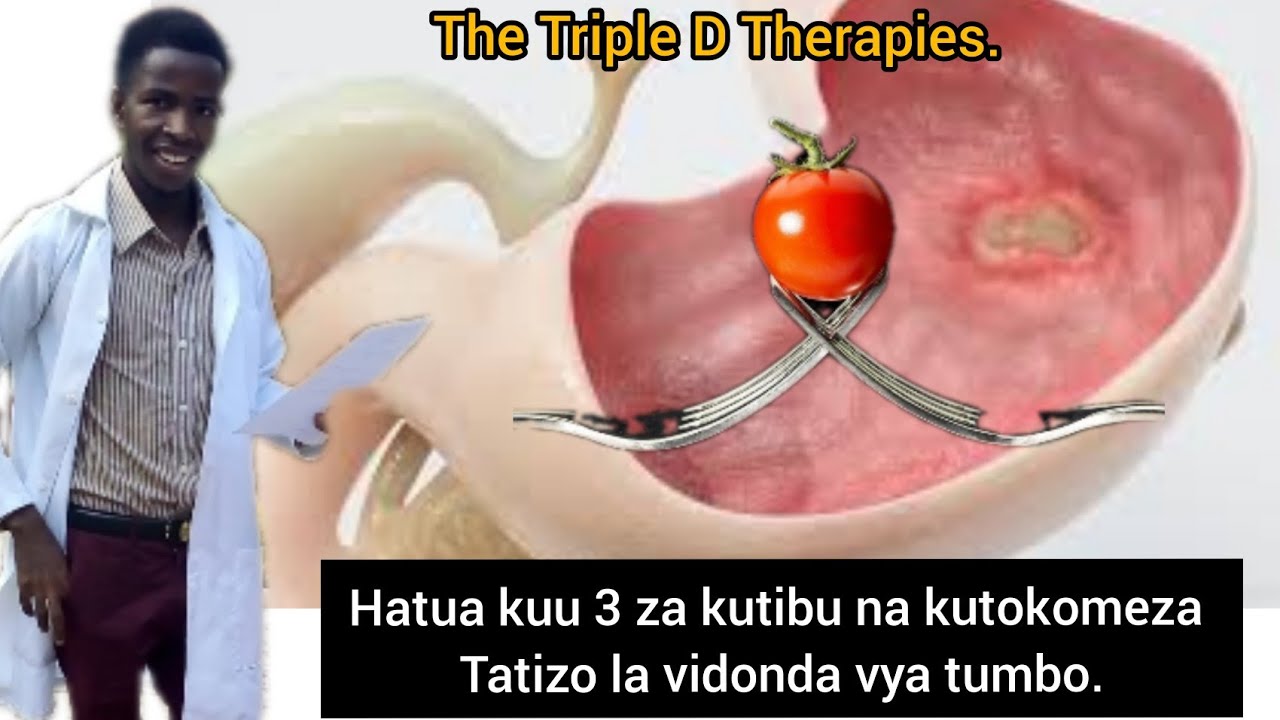 Hatua kuu 3 za kutibu na kutokomeza tatizo la vidonda vya tumbo. "Triple D Therapies".