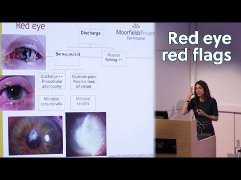 Wideo: Czy surk odnosi się do optometrystów?
