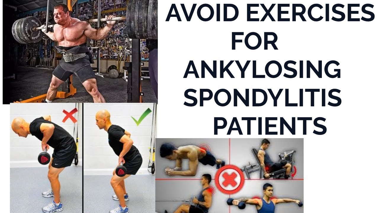 TOP EXERCISES AVOIDS WITH ANKYLOSING SPONDYLITIS YouTube