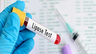 Lipaz (Lps) Nedir? Lipaz Düşüklüğü Ve Yükseliği Ne Anlama Gelir?