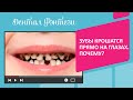 Зубы крошатся прямо на глазах😫 Почему это происходит❓ #детскаястоматология #стоматологиямосква