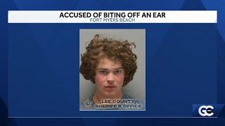Teen Accused Of Biting Victims Ear Off During Fight On Fort Myers Beach