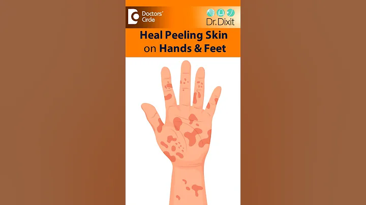 SKIN PEELING from Hand & Feet-Is it Eczema, Psoriasis,Fungus?-Dr.Rasya Dixit|Doctors' Circle #shorts