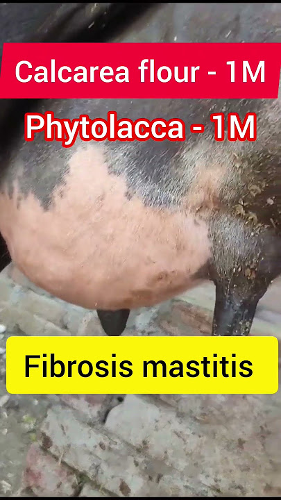 Fibrosis mastitis l Dr Umar Khan