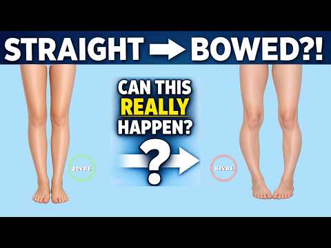 Can straight legs turn into bowlegs with age?