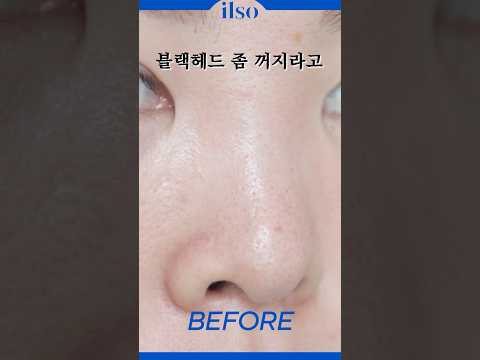 블랙헤드 겁나 쉽게 제거하는 법👃🏻 Do this to <strong>get</strong> rid of <strong>black</strong> heads 코피지/블랙헤드 모공케어까지#shorts