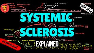 Scleroderma (Systemic Sclerosis) EXPLAINED: Pathogenesis & Diagnosis (USMLE High-Yield) Scleroderma (Systemic Sclerosis) EXPLAINED: Pathogenesis & Diagnosis (USMLE High-Yield)