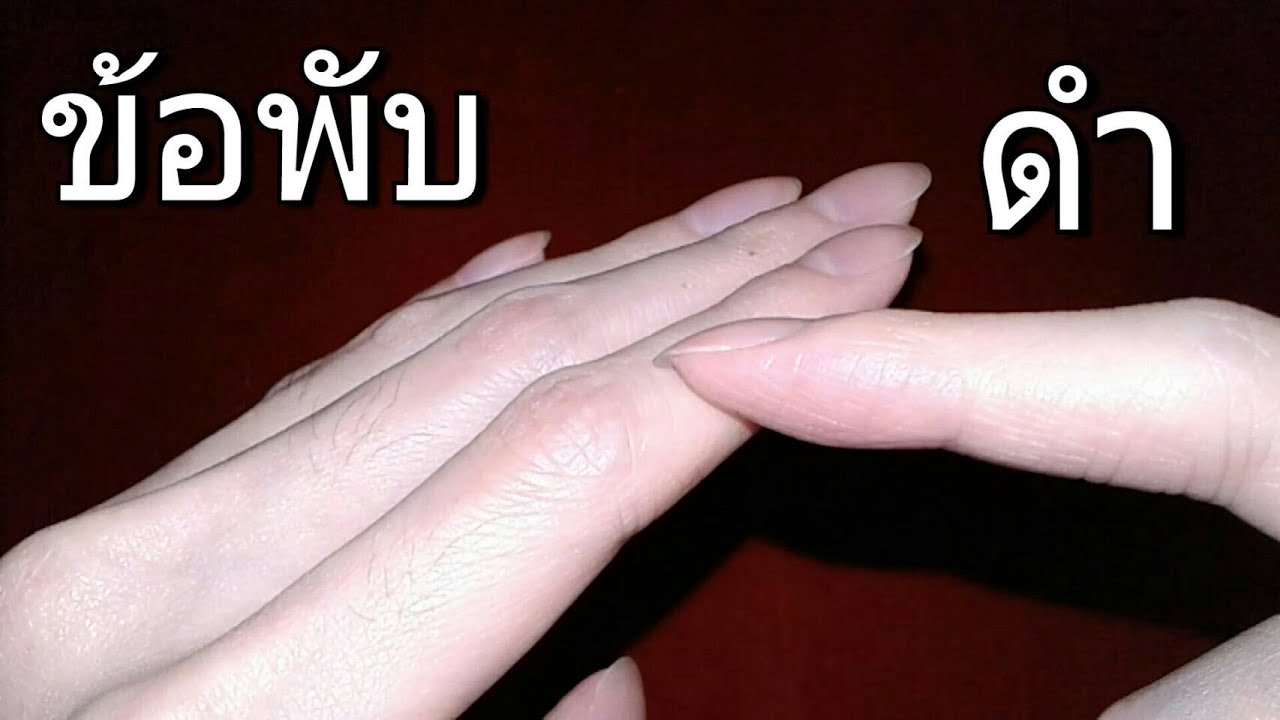 4 วิธีแก้ ข้อพับดำ นิ้วมือ | HAND CAN DO