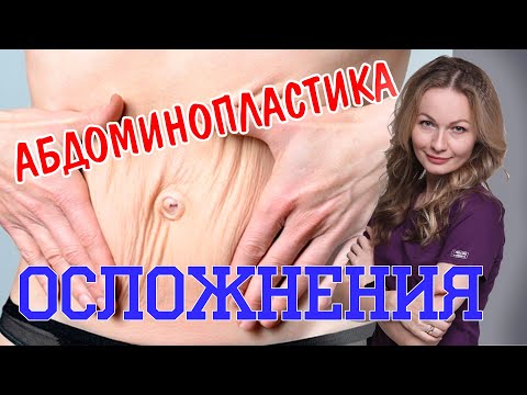 Осложнения после АБДОМИНОПЛАСТИКИ. Чем опасна операция? Чего бояться пациенту?