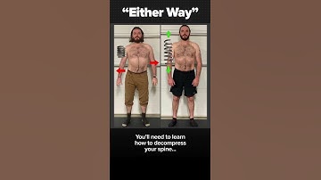 Sciatica Relief Starts with Better Movement