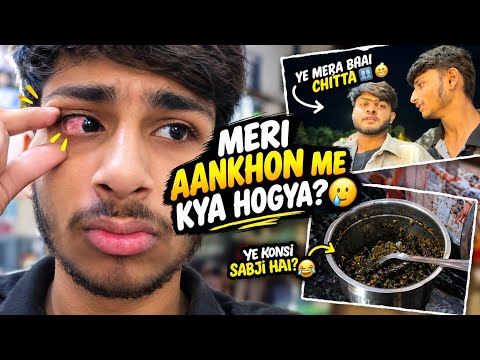 Meri eyes 👀 ko kya ho gya 🥲 #eyes #likeandsubscribe #vlog #viral#viralvideo#subscribe#merabhaistatus