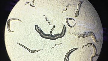 C. elegans Movement Under Microscope || The Effects of Alcohol