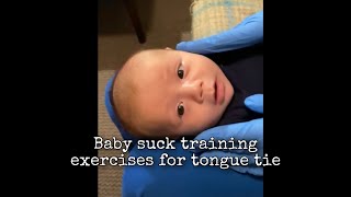 Baby Suck Training Exercises for Tongue Tie