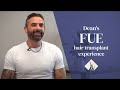 Fue hair transplant at hairpalace  deans experience