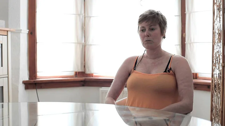 Alex's story - after a stem cell transplant