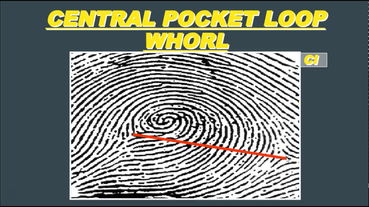 central pocket loop whorl