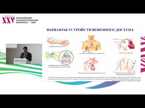 Важные аспекты определения надежного сосудистого доступа у онкологических пациентов
