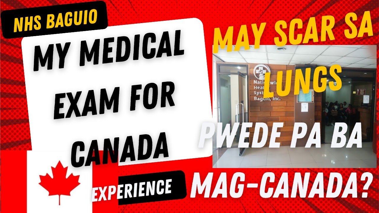Medical exam for Canada Visa application NHS Baguio Sputum Culture