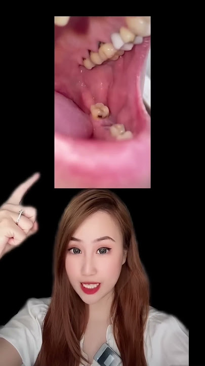 KATE YUP TERNYATA ARTIS!!