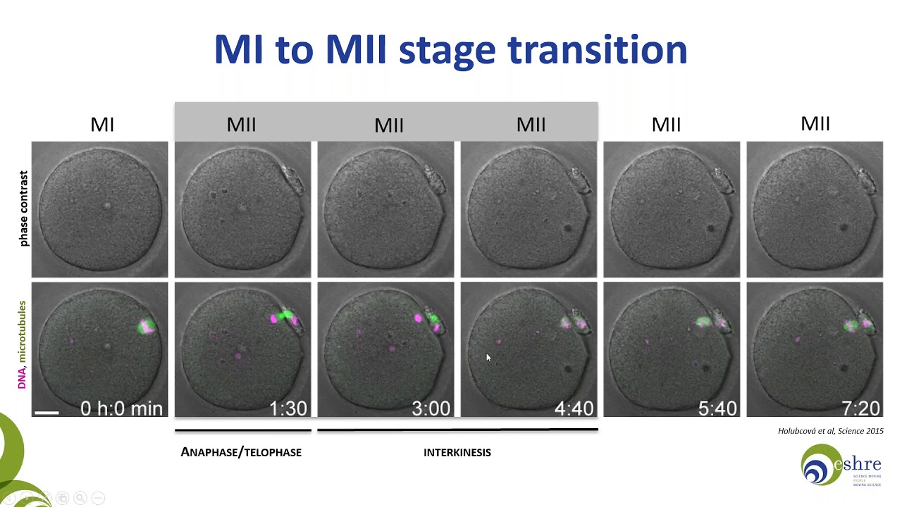 The importance of being mature   Oocyte maturity assessment in clinical practice