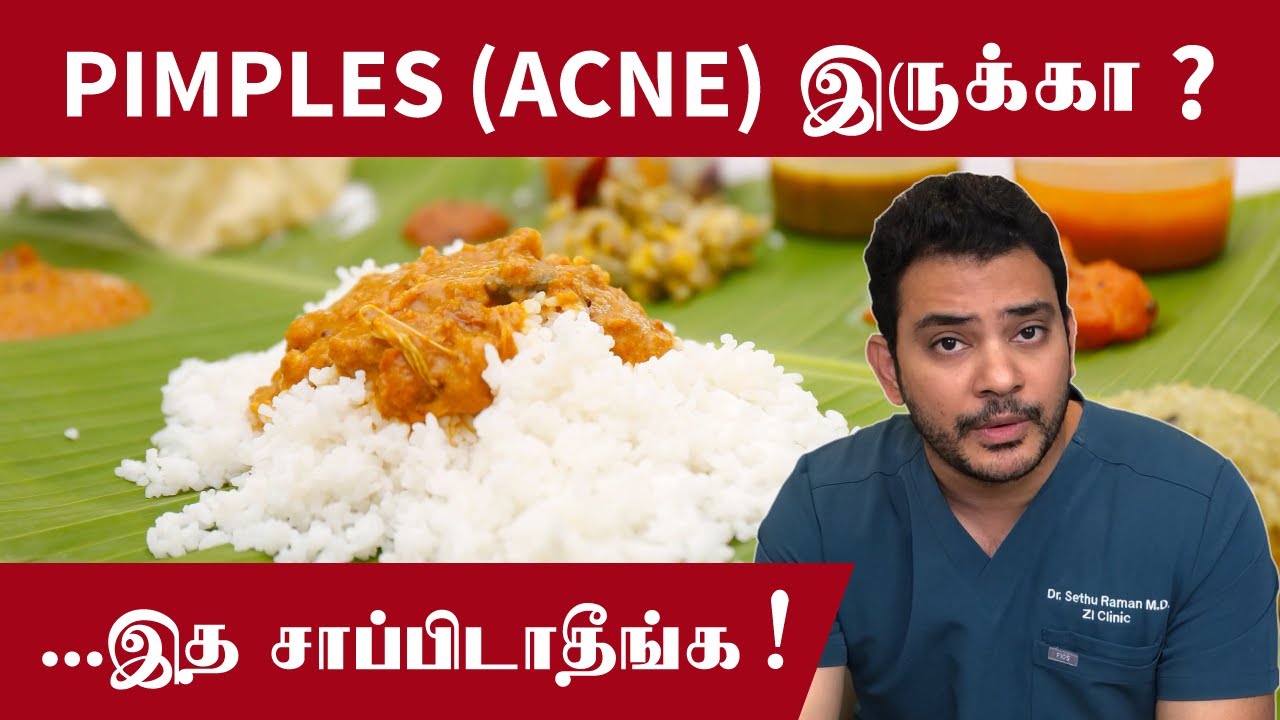 PIMPLES (ACNE) இருக்கா ? ...இத சாப்பிடாதீங்க || What to AVOID for ACNE? (Acne Diet Tips)