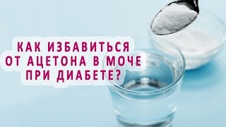 Как избавиться от ацетона в моче при диабете?