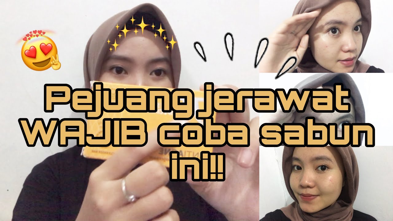 Review Sabun Jf Sulfur Untuk Jerawat Youtube