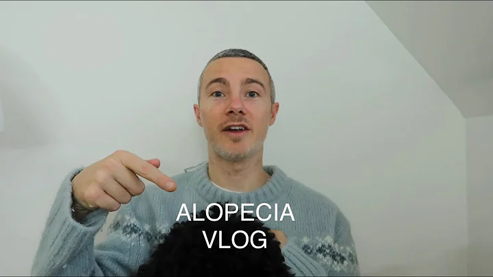 ALOPECIA | HAIR LOSS VLOG part 1