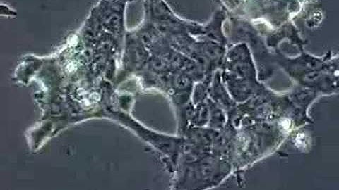 Stem Cells:  Mouse Embryonic Stem Cells