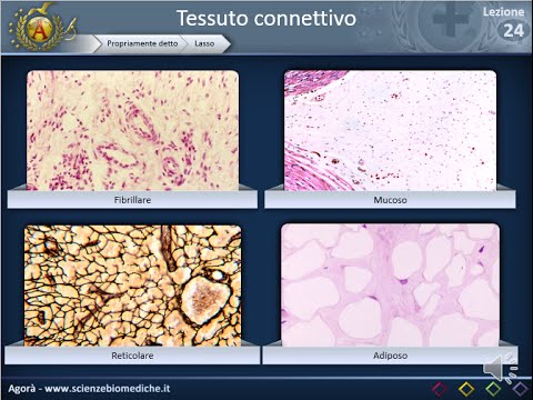 Video: Differenza Tra Tessuto Connettivo Denso Regolare E Denso Irregolare