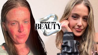 My Tinder Date Blocked Me After Seeing My Skin | Shake My Beauty