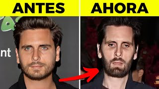 50 Celebrities Who Were Disfigured by Ozempic | Before and After