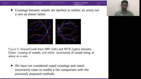 Automatic Classification of Artery/Vein from Single Wavelength Fundus Images.
