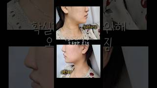인스스 질문폭주한 그놈  30초요약해드림 #리프팅기계  #울트라올라 #홈케어기기