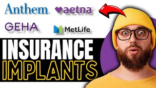 Best Dental Insurance For Implants Of 2024