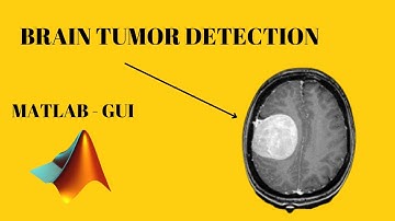 Brain Tumor Detection using Segmentation | Matlab GUI | Image Processing