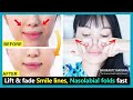 Best 6 exercises to Lift smile lines, reduce nasolabial folds, fix sagging cheeks fast.