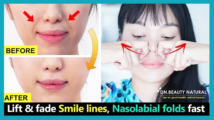 Best 6 exercises to Lift smile lines, reduce nasolabial folds, fix sagging cheeks fast.