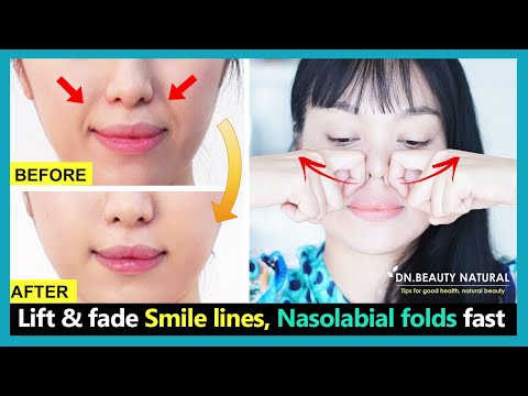 Best 6 exercises to Lift smile lines, reduce nasolabial folds, fix sagging cheeks fast.