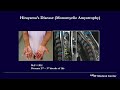 Management Strategies and Surgical Techniques for Complex Cervical Spine Pathology - Lee Tan, MD